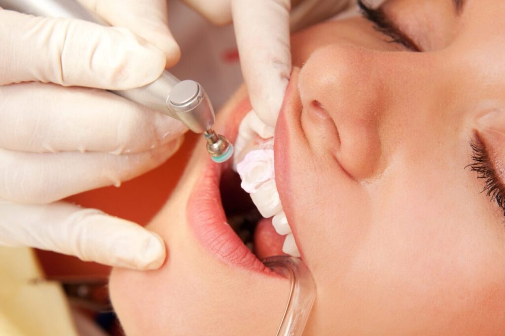 A woman's face with mouth open, receiving dental treatment from gloved hands using a tool on her teeth, in a clinical setting for cosmetic orthodontics.